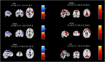 Aberrant Functional Connectivity of Sensorimotor Network and Its Relationship With Executive Dysfunction in Bipolar Disorder Type I